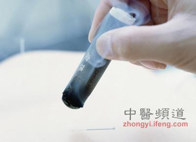 點擊將在新窗口查看全圖 中醫(yī)艾灸養(yǎng)生的十大禁忌