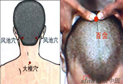 常見病艾灸時怎樣選穴？--大椎百會穴