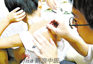 灸法的種類  你知道多少？